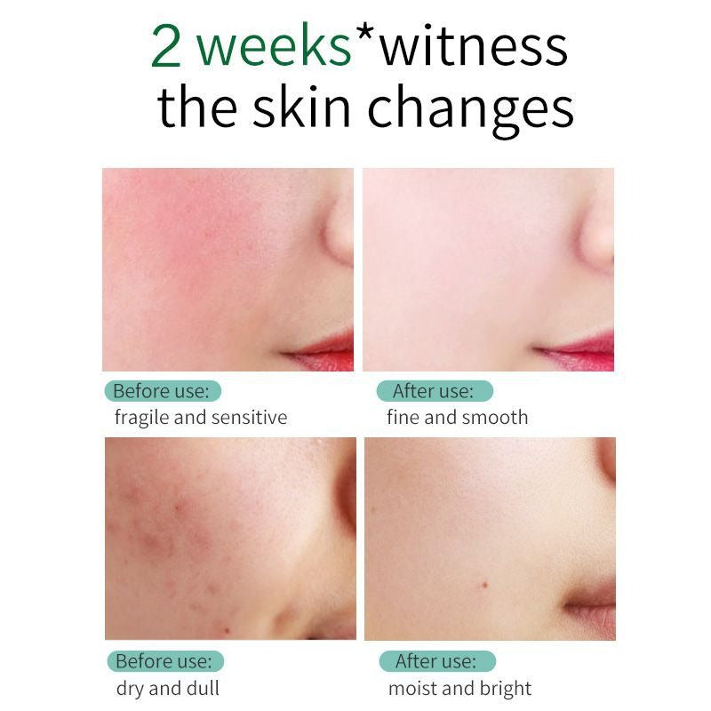 Goodies Mall SKIN EVER Centella Repair Face Cream